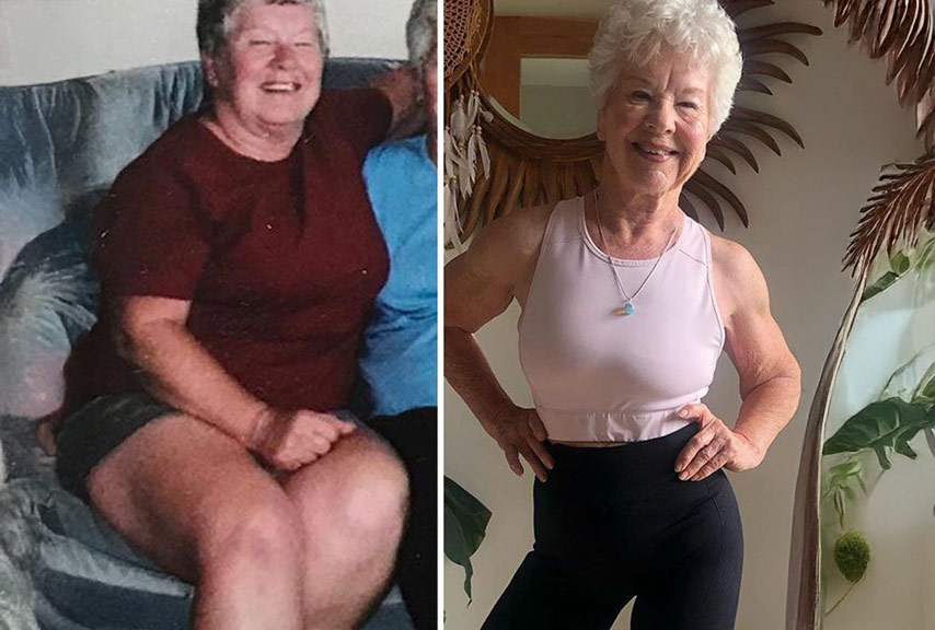 Hannelore Vorher-Nachher